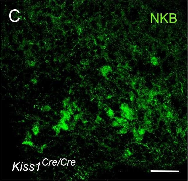 Immunohistochemistry: Neurokinin B Antibody - BSA Free [NB300-201] - Characterization of Kiss1-null mice.(A-C) Immunofluorescence for kisspeptin (A,B) & NKB (C) in the ARN of wild-type (A) & Kiss1-null (B,C) female mice. (D) Cell-attached recordings showing the effects of 100 nM NKB on firing of KNDy neurons in acute brain slices prepared from female heterozygous Kiss1Cre/+ and homozygous (null) Kiss1Cre/Cre;Rosa26-tdT mice. (E) Mean ± SEM changes in KNDy neuron firing evoked by 100 nM NKB in heterozygous Kiss1Cre/+and homozygous (null) Kiss1Cre/Cre;Rosa26-tdT mice. Image collected & cropped by CiteAb from the following publication (//pubmed.ncbi.nlm.nih.gov/33464205), licensed under a CC-BY license. Not internally tested by Novus Biologicals.