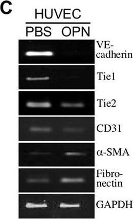 Western Blot: GAPDH Antibody (1D4) [NB300-221] - OPN induces EndoMT. (C) mRNA levels of VE-cadherin, Tie1, Tie2, CD31,  alpha -SMA, & fibronectin in HUVECs pre-incubated 16 h with 2% FBS-containing medium & then treated 15 h with PBS or 0.3 μg/ml of OPN. Image collected & cropped by CiteAb from the following publication (//pubmed.ncbi.nlm.nih.gov/29435158), licensed under a CC-BY license. Not internally tested by Novus Biologicals.