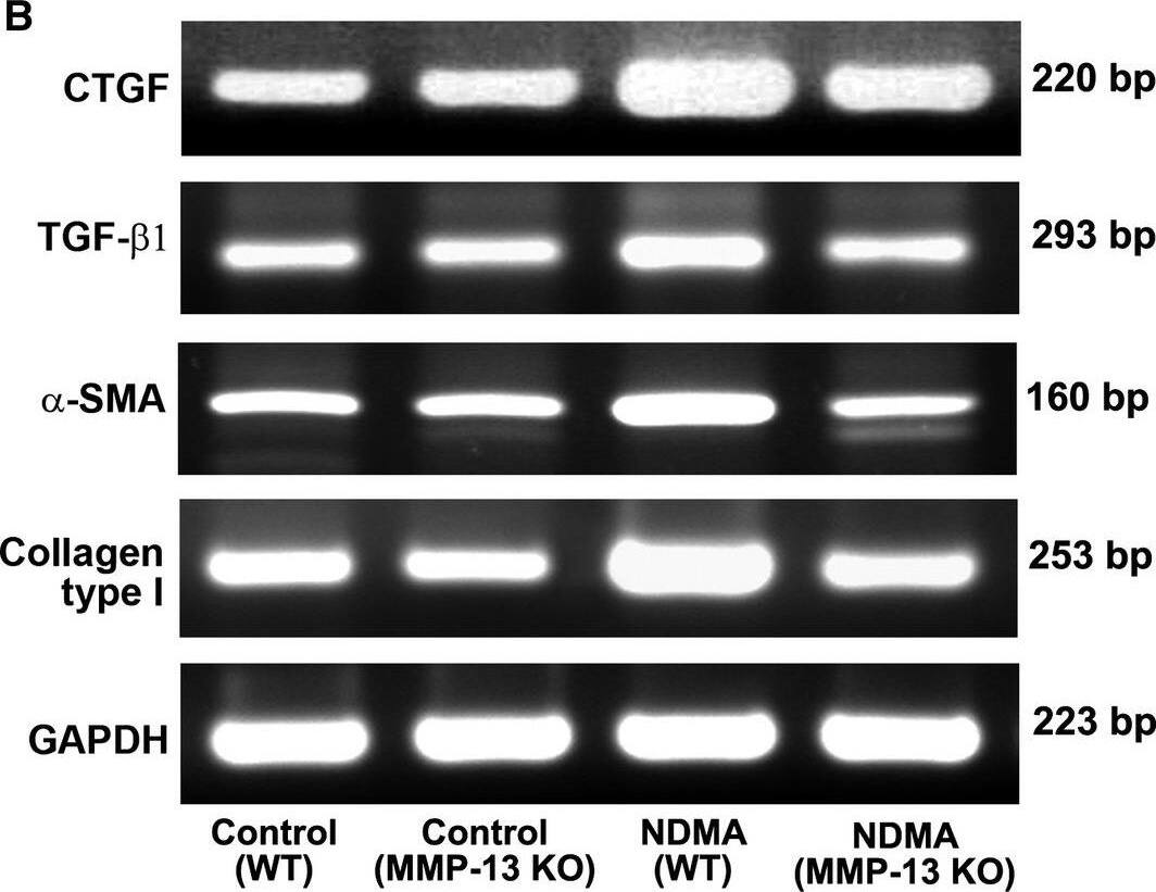 Western Blot: GAPDH Antibody (1D4) [NB300-221] - Expression of CTGF & TGF‐ beta 1 in WT & MMP‐13 KO mice treated without & with NDMA. (A) Real‐time PCR analysis for the quantitative expression of CTGF, TGF‐ beta 1,  alpha ‐SMA & collagen type 1 mRNA in WT & MMP‐13 KO mice. The data are mean ± S.D. of six samples per group. ***P < 0.001 NDMA‐treated WT mice versus control untreated WT mice; *P < 0.05 NDMA‐treated MMP‐13 KO mice versus untreated MMP‐13 KO mice; #P < 0.001 NDMA‐treated MMP‐13 KO mice versus NDMA‐treated WT mice. (B) Semiquantitative RT‐PCR for the expression of CTGF, TGF‐ beta 1,  alpha ‐SMA & type 1 collagen mRNA in WT & MMP‐13 KO mice treated without & with NDMA. GAPDH was used as a loading control. The data are representative of six samples in each group. Image collected & cropped by CiteAb from the following publication (//pubmed.ncbi.nlm.nih.gov/28782260), licensed under a CC-BY license. Not internally tested by Novus Biologicals.