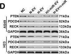 Western Blot: GAPDH Antibody (1D4) [NB300-221] - miR-21-5p delivery by H-EV treatment promote NSCLC cell proliferation, survival & mobility by targeting PTEN, PDCD4 & RECK. a–d, western blot detecting PTEN, PDCD4 & RECK protein expression level in A549 or H23 cells after different treatment as described in Fig. 4. e–k, cell functional assay as described in Fig. 1. A549 or H23 cells with or without PTEN, PDCD4 or RECK gene overexpression (O/E) were tested. Wild type, non-treated A549 or H23 cells were used as negative control (NC). Bar in K indicates 20 μm. Tukey’s test was used for statistical analysis. *, p < 0.05; **, p < 0.01; ***, p < 0.001; ****, p < 0.0001 Image collected & cropped by CiteAb from the following publication (//pubmed.ncbi.nlm.nih.gov/30736829), licensed under a CC-BY license. Not internally tested by Novus Biologicals.