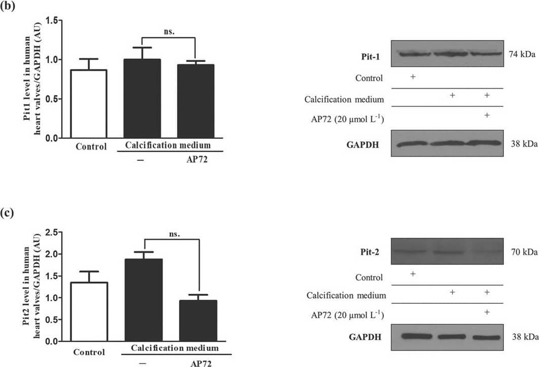 Western Blot: GAPDH Antibody (1D4) [NB300-221] - Hydrogen sulfide donors leads to inhibition of phosphate transport. Cells were cultured in a normal or calcific environment exposed to AP72 (20 μmol·L−1) for 5 days. (a) Phosphate content was determined using QuantiChrom quantitative colorimetric assay. (b) Pit1 & (c) Pit2 western blotting was performed & normalized to GAPDH. Data shown are means ± SEM of five independent experiments. *P < .05, significantly different as indicated; ns, not significant Image collected & cropped by CiteAb from the following publication (//pubmed.ncbi.nlm.nih.gov/31017307), licensed under a CC-BY license. Not internally tested by Novus Biologicals.