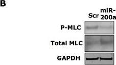 Western Blot: GAPDH Antibody (1D4) [NB300-221] - miR-200a associated elongation is associated with decreased actomyosin contractility.(A) The effect of miR-200a transfection on mRNA levels was measured for predicted target genes in Wm266.4 melanoma cells using GAPDH as a control. (B) Transfection of Wm266.4 cells with miR-200a leads to decreased pMLC levels. Image collected & cropped by CiteAb from the following publication (//pubmed.ncbi.nlm.nih.gov/20957176), licensed under a CC-BY license. Not internally tested by Novus Biologicals.