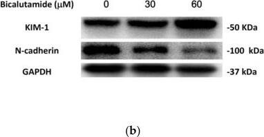 Western Blot: GAPDH Antibody (1D4) [NB300-221] - Lactate dehydrogenase (LDH) assay & the Western blot of kidney injury molecule (KIM)-1 & N-cadherin in rat mesangial cells (RMCs). Cells were treated with bicalutamide (Bic) at concentrations of 30 & 60 μM at 24 h. (a) LDH release was increased by Bic (n = 3, * p < 0.05). (b) A representative blot of protein expressions of KIM-1 & N-cadherin. GAPDH was used as an internal control. (c) Quantitative data of Western blotting of KIM-1(n = 3, * p < 0.05). (d) Quantitative data of Western blotting of N-cadherin (n = 3, * p < 0.05). When RMCs were treated with Bic, N-cadherin dose-dependently decreased, however KIM-1 was significantly induced in the group treated with 60 μM. Image collected & cropped by CiteAb from the following publication (//pubmed.ncbi.nlm.nih.gov/32403414), licensed under a CC-BY license. Not internally tested by Novus Biologicals.