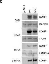 Western Blot: GAPDH Antibody (1D4) [NB300-221] - Demonstration of the advantages of crude fractionation over whole cell lysis & scale up of the approach. (A) HEK293 cells were plated at a density of 4 × 105 cells per well of a 12 well plate & subsequently lysed directly in NP40 or RIPA lysis buffer or processed according to the protocol in Figure 2 (Sequential). An aliquot of each extract was then analyzed by 4-12% SDS PAGE followed by staining with Coomassie blue or by Western blotting & probing with antibodies to various marker proteins of specific intracellular organelles as previously. (B) HEK293 cells were plated at a density of 4 × 105 cells per well of a 12 well dish & then transfected the next day in triplicate with 400 ng of a construct encoding V5/6×-HIS tagged ERGIC-53. Cells were extracted 48 hours later either directly in RIPA buffer, directly in NP40 buffer or according to our extraction protocol. Proteins were then partially purified from each extract using Nickel resin (SIGMA #P6611) & eluted proteins were analyzed by 10% SDS PAGE followed by staining with Coomassie blue or by Western blotting & probing with the anti V5 antibody. (C) HEK293 cells were plated at a density of 4 × 105 cells per well of a 12 well dish & then transfected the next day in with 1600 ng of pcDNA6/V5-His (Invitrogen) or constructs encoding WT or MUT COMP. Cells were harvested 48 hours later & extracted according to our protocol. (D) HEK293 cells were plated at a density of 4 × 105 cells per well of a 12 well dish or 8.4 × 105 cells per well of a 35 mm dish & processed according to the protocol in Figure 2. An aliquot of each extract was then analyzed by 4-12% SDS PAGE followed by Western blotting & probing with antibodies to GAPDH, BiP & Lamin A. Image collected & cropped by CiteAb from the following publication (//pubmed.ncbi.nlm.nih.gov/20003239), licensed under a CC-BY license. Not internally tested by Novus Biologicals.