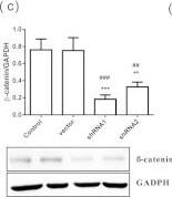 Western Blot: GAPDH Antibody (1D4) [NB300-221] - Inhibition of AKT/GSK3 beta / beta -catenin signaling pathway decreased HMGB1-induced EMT.(a) BEAS-2B cells treated w/ 10 μM PI3K inhibitor (LY294002) & GSK-3 beta  inhibitor (SB415286) for 10 min, & then treated w/ HMGB1 (300 ng/mL) for 24 h. Protein expression detected by WB analysis. Quantification of E-cadherin, ZO-1, & vimentin performed using ImageJ software. Data are expressed as mean ± SD (n = 5). #p < 0.05, as compared w/ control group. *p < 0.05, as compared w/ HMGB1-treated group. (b) BEAS-2B cells transduced w/ lentiviral-expressed  beta -catenin shRNA (1 MOI) for 72 h & selected by puromycin. The mRNA from stable clones expressing  beta -catenin-targeting shRNAs analyzed by quantitative real-time PCR. Data are expressed as mean ± SD (n = 5). ##p < 0.01, ###p < 0.001, as compared w/ control group. **p < 0.01, ***p < 0.001, as compared w/ vector group. (c)  beta -catenin protein expression detected by WB analysis in a stable  beta -catenin shRNA BEAS-2B cell clone. Quantification of protein expression performed using ImageJ software. Data are expressed as mean ± SD (n = 3). ##p < 0.01, ###p < 0.001, as compared w/ control group. **p < 0.01, ***p < 0.001, as compared w/ vector group. (d) A stable  beta -catenin shRNA BEAS-2B cell clone treated w/ HMGB1 (300 ng/mL) for 24 h, & protein expression of E-cadherin, ZO-1, & vimentin detected by WB analysis. Quantification of protein expression performed using ImageJ software. Data are expressed as mean ± SD (n = 4). #p < 0.05, as compared w/ control group. *p < 0.05, as compared w/ HMGB1 group. In immunoblotting assay, gels have been run under the same experimental conditions. Then cropped blots incubated w/ different primary antibodies for analysis of signaling pathway. Image collected & cropped by CiteAb from the following publication (//pubmed.ncbi.nlm.nih.gov/26739898), licensed under a CC-BY license. Not internally tested by Novus Biologicals.