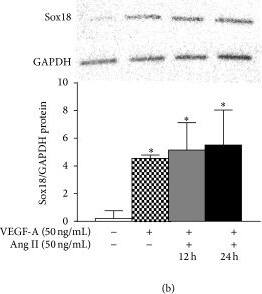 Western Blot: GAPDH Antibody (1D4) [NB300-221] - Ang II positively regulates VEGF-A-mediated EC differentiation: the effect of Ang II on VEGF-A-stimulated differentiation of MSCs into ECs was examined. AT2R & VEGFR-2 mRNA expression was analyzed by RT-PCR (n = 3) (a). Sox18 protein levels were measured by Western blot analysis (n = 3) (b). Expression of EC markers was determined by FACS analysis, & a representative grid is shown (n = 5-6) ((c)–(g)). Endothelial tube formation was examined using an angiogenesis assay (n = 3) ((d)–(h)). Experiments were performed with samples taken from independent BM-MSC cultures from separate microswine. HUVECs were excluded from statistical analyses. Data are shown as mean ± SD. ∗p < 0.05 versus naïve MSCs & #p < 0.05 MSCs treated with VEGF-A versus VEGF-A plus Ang II cotreatment. Image collected & cropped by CiteAb from the following publication (//pubmed.ncbi.nlm.nih.gov/26106428), licensed under a CC-BY license. Not internally tested by Novus Biologicals.