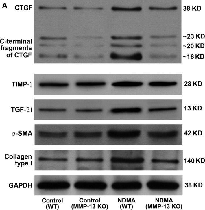 Western Blot: GAPDH Antibody (1D4) [NB300-221] - Protein expression of CTGF, TIMP‐1, TGF‐ beta 1,  alpha ‐SMA & collagen type 1 in WT & MMP‐13 KO mice treated without & with NDMA. (A) Western blotting for the proteins of full‐length CTGF & its C‐terminal fragments, TIMP‐1, active TGF‐ beta 1,  alpha ‐SMA & collagen type 1 in the liver tissues from WT & MMP‐13 KO mice. The images are representative of six Western blots per each group. (B) Quantitative analysis of Western blot images. The data are mean ± S.D. of six images per group. ***P < 0.001 NDMA‐treated WT mice versus control untreated WT mice & NDMA‐treated MMP‐13 KO mice versus untreated MMP‐13 KO mice; **P < 0.01 NDMA‐treated MMP‐13 KO mice versus untreated MMP‐13 KO mice; *P < 0.05 NDMA‐treated MMP‐13 KO mice versus untreated MMP‐13 KO mice; #P < 0.001 NDMA‐treated MMP‐13 KO mice versus NDMA‐treated WT mice; @, P < 0.05 NDMA‐treated MMP‐13 KO mice versus NDMA‐treated WT mice. Image collected & cropped by CiteAb from the following publication (//pubmed.ncbi.nlm.nih.gov/28782260), licensed under a CC-BY license. Not internally tested by Novus Biologicals.