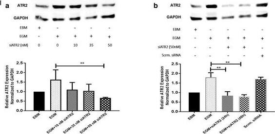 Western Blot: GAPDH Antibody (1D4) [NB300-221] - ATR2 siRNA transfection & immunophenotyping for EC markers. I Concentration selection for siRNA transfection. Three different concentrations (10, 35, & 50 nM) of ATR2 siRNA were used according to the manufacturer’s protocol. Western blot analysis showed inhibition of ATR2 by 10, 35, & 50 nM of ATR2 siRNA. However, 50 nM of ATR2 siRNA showed the highest inhibition among all three different concentrations (A). ATR2 silencing by siRNA transfection with EGM compared with AMSCs with EGM & EGM + scrambled siRNA (negative control) (B). GAPDH was used as a housekeeping gene. II Flow cytometric analysis of PECAM1 (CD31) in four different groups; control group with EGM (A), AMSCs with EGM & MMP-2 siRNA (B), AMSCs with EGM & MMP-14 siRNA (C), & HUVECs as the positive control (D). Cell transfection with 5 μM of ATR2 siRNA for EGM (E), AMSCs with EGM & MMP-2 siRNA (F), & AMSCs with EGM & MMP-14 siRNA (G). Flow cytometry data were analyzed to show the significant differences between the groups (H). III Flow cytometric analysis of VE-cadherin (CD144) in four different groups: control group AMSCs with EGM (A), AMSCs with EGM & MMP-2 siRNA (B), AMSCs with EGM & MMP-14 siRNA (C), & HUVECs as the positive control (D). Cell transfection with 5 μM of ATR2 siRNA for EGM (E), AMSCs with EGM & MMP-2 siRNA (F), & AMSCs with EGM & MMP-14 siRNA (G). Flow cytometry data were analyzed to show the significant differences between the groups (H). **p < 0.01. EBM endothelial cell basal medium, EGM endothelial cell growth medium, MMP matrix metalloproteinase, ATR2 angiotensin receptor R2, HUVEC human umbilical vein endothelial cell Image collected & cropped by CiteAb from the following publication (//pubmed.ncbi.nlm.nih.gov/28499402), licensed under a CC-BY license. Not internally tested by Novus Biologicals.