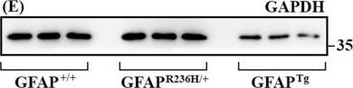 Western Blot: GAPDH Antibody (1D4) [NB300-221] - Analysis of GFAP in mouse models of AxD by immunoblotting.Urea-soluble fractions extracted from wild type (GFAP+/+), R236H mutant knockin (GFAPR236H/+) & human wild type GFAP transgenic (GFAPTg) mice (n = 3 for each genotype) were analyzed by immunoblotting with indicated anti-GFAP antibodies (A-D). Immunoblots were also probed with antibodies specific to  alpha B-crystallin (F) & GAPDH (E), which was used as a loading control. Representative images were shown, with the antibody used for immunoblotting was indicated above each panel. Approximate molecular weight markers (in kDa) were shown on the right. Dashed lines indicated lanes that samples run on the same gel but were noncontiguous (D & F). Notice that although all anti-GFAP antibodies tested recognized full-length GFAP (A-D), both 2.2B10 (A) & SMI-21 (B) antibodies also detected GFAP degradation products sized between 25 & 35 kDa in GFAPTg mice. The level of  alpha B-crystallin (F) was increased in both GFAPR236H/+ & GFAPTg mice compared to wild type controls (GFAP+/+). Image collected & cropped by CiteAb from the following publication (//dx.plos.org/10.1371/journal.pone.0180694), licensed under a CC-BY license. Not internally tested by Novus Biologicals.