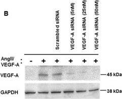 Western Blot: GAPDH Antibody (1D4) [NB300-221] - Silencing of endogenous VEGF-A lacks an effect on mesenchymal stem cell differentiation into endothelial cells. Differentiating mesenchymal stem cells (MSCs) were transfected with small interfering RNA (siRNA) directed against vascular endothelial growth factor (VEGF-A) & then examined for endothelial cell (EC) marker expression. Treatment of MSCs with the cocktail of VEGF-A (2 ng/ml) plus angiotensin II (Ang II; 2 ng/ml) for 24 hours induced a synergistic increase in VEGF transcript as compared with VEGF-A alone or Ang II alone (A). VEGF-A mRNA was normalized to glyceraldehyde-3-phosphate dehydrogenase (GAPDH) mRNA (A). Standardization experiments demonstrated that 50 nM siRNA directed against VEGF completely abrogated VEGF protein expression (B). Fluorescence-activated cell sorting analysis revealed that there was no significant difference in EC marker expression between differentiating MSCs that received VEGF-A siRNA or scrambled control siRNA (C, D, E). Note that human umbilical vein endothelial cells (HUVECs) were excluded from the statistical analyses. *P <0.05 vs. naïve MSCs. #P <0.05 vs. VEGF-A (2 ng/ml)-treated MSCs or Ang II (2 ng/ml)-treated MSCs alone, n = 3. Image collected & cropped by CiteAb from the following publication (//stemcellres.biomedcentral.com/articles/10.1186/scrt538), licensed under a CC-BY license. Not internally tested by Novus Biologicals.