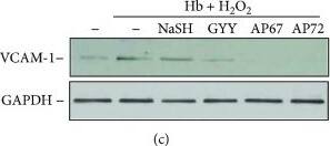 Western Blot: GAPDH Antibody (1D4) [NB300-221] - Endothelial responses provoked by Hb-lipid interactions are attenuated by sulfide donors. (a) OxLDL (200 μg/mL) was incubated with sulfide donors NaSH, GYY4137, AP67, & AP72 at the concentrations of 20 & 200 μmol/L at 37°C for 24 hours. Confluence HAoECs were exposed to the LDL samples for 4 hours then cell viability was determined by MTT assay. Representative experiment, n = 3, each performed in 8 wells in parallel. (b) OxLDL (200 μg/mL) was incubated with sulfide donors NaSH, GYY4137, AP67, & AP72 at the concentration of 20 & 200 μmol/L at 37°C for 24 hours. Confluence HAoECs were exposed to LDL samples (50 μg/mL) for 8 hours. HO-1 & HO-2 protein expressions were determined by Western blotting. Representative experiment, n = 3. (c–e) Hb (10 μmol/L) was incubated with H2O2 (50 μmol/L) in the presence or absence of sulfide donors NaSH, GYY4137, AP67, & AP72 (200 μmol/L) at 37°C for 90 minutes. (c) Confluence HAoECs were exposed to the obtained Hb samples for 8 hours & VCAM-1 expression was determined by Western blotting. Representative experiment, n = 3. (d, lower panel) Confluence HAoECs cultured in ECIS plates were exposed to the obtained Hb samples & transendothelial electrical resistance was monitored by ECIS instrument for 3 hours. Representative experiment, n = 3, each performed in triplicate (d, upper panel). HAoECs grown on coverslips, upon reaching confluence cells were exposed to the Hb samples for 8 hours. Cells were stained for F-actin (phalloidin-TRITC, red) & DNA (Hoechst, blue). White arrows show intercellular gaps. Representative image, n = 5. ∗∗ indicates statistical significance (p < 0.001). ∗∗∗ indicates statistical significance (p < 0.0001). Image collected & cropped by CiteAb from the following publication (//pubmed.ncbi.nlm.nih.gov/29560080), licensed under a CC-BY license. Not internally tested by Novus Biologicals.