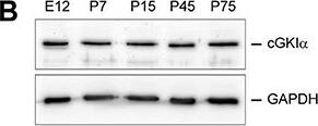 Western Blot: GAPDH Antibody (1D4) [NB300-221] - Expression of Npr2 & cGKI alpha  in DRGs at different developmental stages. (A,B) Western blot of membrane or cytosolic fractions of DRGs using antibodies to Npr2 or to cGKI alpha , respectively. The heavy chain of clathrin or GAPDH served as loading control. (C–E) Sections through thoracic DRGs at different stages. Localization of anti-beta Gal staining indicating Npr2-expression is demonstrated in the Npr2wt/LacZ-mouse reporter & localization of cGKI alpha  by a polyclonal antibody to mouse cGKI alpha . Scale bars in (C1,D1), 50 μm; in (C2-C5,D2-D5), 100 μm; in (E) 25 μm. (F) Quantification of Npr2-positive & cGKI alpha -positive neurons in DRGs counterstained with an antibody to PGP9.5 at different stages. (G–I) A small proportion of Npr2-positive DRG neurons at P45 & P75 express trkA, parvalbumin, CGRP or IB4. Scale bars in (H,I), 20 μm. Image collected & cropped by CiteAb from the following publication (//pubmed.ncbi.nlm.nih.gov/29472841), licensed under a CC-BY license. Not internally tested by Novus Biologicals.