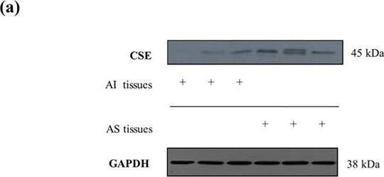 Western Blot: GAPDH Antibody (1D4) [NB300-221] - Expression of CSE in human aortic valves. (a) Western blot of CSE protein from AS valve (N = 12) lysates & AI valve (N = 9) lysates (left panel) were performed. Representative CSE protein levels of three AS & three AI valves lysates were shown. Relative CSE levels were assessed by densitometry analyses of band intensities of CSE western blots normalized to GAPDH (panel right). (b) Zn2+ precipitated sulfide content under alkaline conditions was measured in AI (N = 18) & AS (N = 18) valve tissues normalized to protein content of the individual samples. (c) VIC derived from different AI (N = 6) & AS (N = 9) patients were cultured in calcification medium. CSE expression was measured after the initiation of calcification. Results were normalized to GAPDH of the samples. (d) Double immunohistochemistry of CSE‐SMA & CSE‐ALP was shown with two different magnifications (×400 magnification & ×1,000 magnification). Data shown are means ± SEM of N experiments. *P < .05, significantly different as indicated Image collected & cropped by CiteAb from the following publication (//pubmed.ncbi.nlm.nih.gov/31017307), licensed under a CC-BY license. Not internally tested by Novus Biologicals.