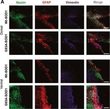 Immunocytochemistry/ Immunofluorescence Vimentin Antibody