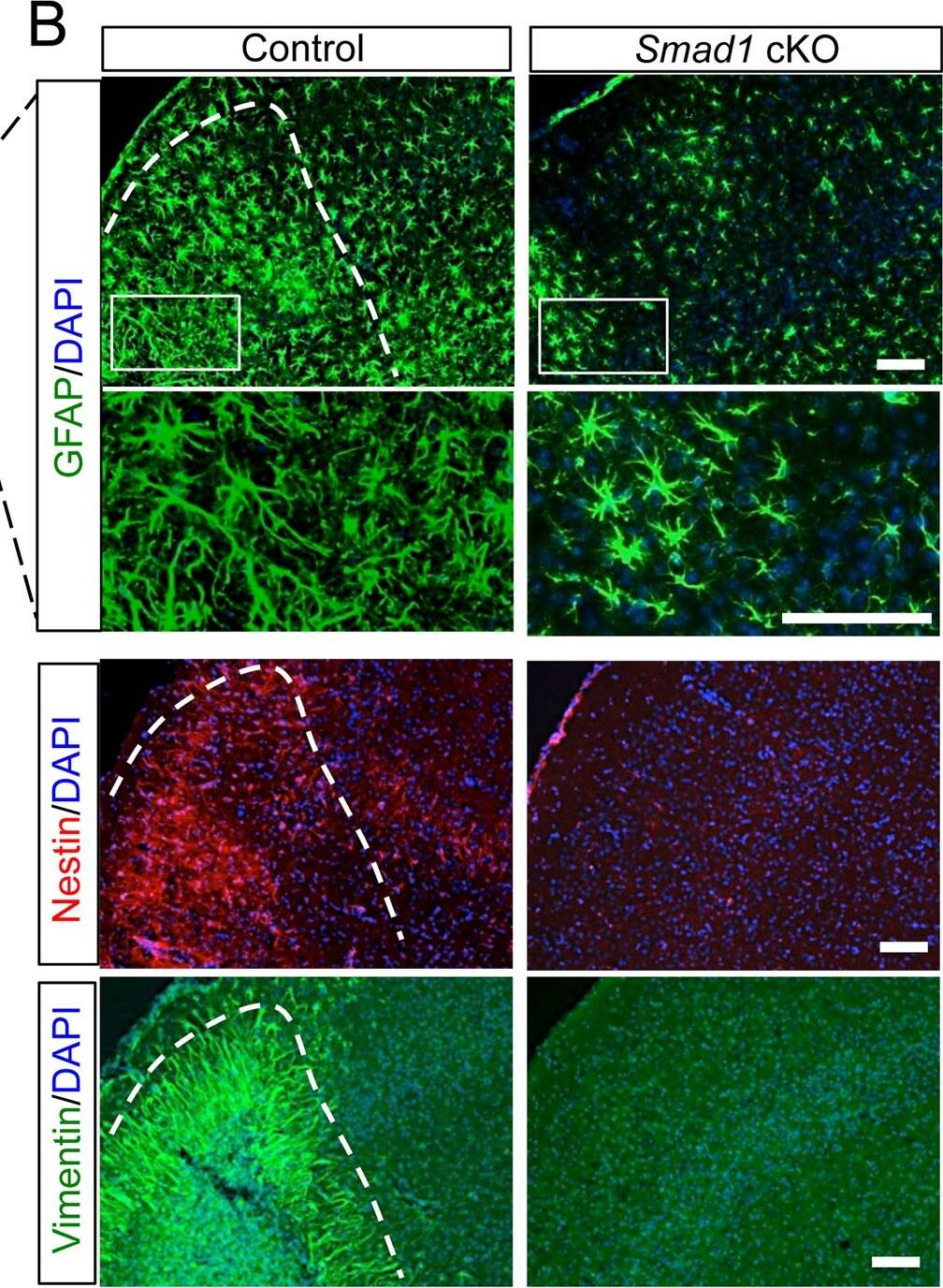 Immunocytochemistry/ Immunofluorescence: Vimentin Antibody [NB300-223] - Attenuated reactive astrocytosis after stroke in Smad1 cKO mice.(A) Images of IHC for reactive astrocyte marker GFAP on ipsilateral hemisphere at 7 days (top two panels) or 3 months (bottom panels) post-stroke. The border between the stroke core & peri-infarct area is outlined by dotted lines. Arrows point to striatal infarct core. (B) Enlarged IHC images of boxed areas in (A) at the cortical peri-infarct area (blue box in D) with the indicated reactive astrocyte markers GFAP, Nestin, & Vimentin. Enlarged images of GFAP IHC highlight the hypertrophic morphology of GFAP+ astrocytes in mutants. (C) Quantification of the number of GFAP+ astrocytes & the intensity of GFAP immunoreactivity (IR) at the peri-infarct area shown in (B). n = 4, one-way ANOVA for the number of astrocytes, unpaired Student’s t-test for GFAP intensity, ***p<0.001, Ipsi, ipsilateral; Ctra, contralateral cortex. (D) Diagram of infarct territory affected by tMCAO (blue) & peri-infarct cortical area (blue box). (E) Reactive astrocytosis was similarly attenuated in the ipsilateral hippocampus of Smad1 cKO mice. Scale, 500 μm (A), 100 μm (B), & 200 μm (E). Image collected & cropped by CiteAb from the following publication (//dx.plos.org/10.1371/journal.pone.0136967), licensed under a CC-BY license. Not internally tested by Novus Biologicals.