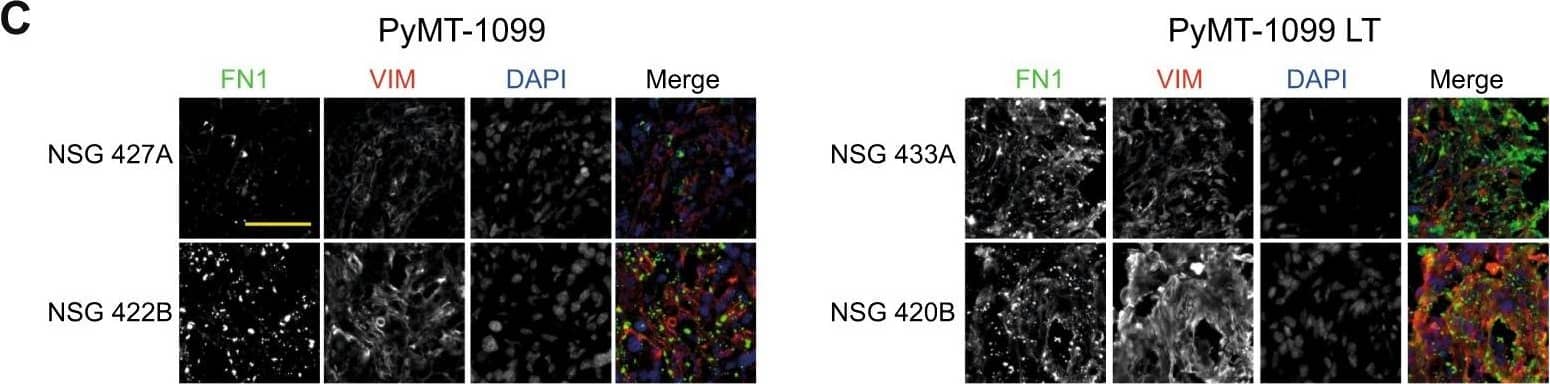 Immunocytochemistry/ Immunofluorescence: Vimentin Antibody [NB300-223] - Increased numbers of differentiating NSPCs in SVZ of G93A-SOD1 brain. (A) Confocal microscopy images of dorsal & ventral regions of SVZ in G93A-SOD1 & Wt-SOD1 brain at postnatal week 18, stained for nestin (green), GFAP (red), & vimentin (blue). Scale bar = 50 μm. (B) Quantification of nestin-, GFAP-, & vimentin-positive cells in SVZ of G93A-SOD1 & Wt-SOD1 mice. Data are means ± SD of 3 mice per group. **p 20 days (PyMT-1099 LT) were injected orthotopically into mammary fat pads of NSG mice. The graph represents tumor growth in PyMT-1099 & PyMT-1099 LT group of mice. (B) Histological tumor sections from tumors of PyMT-1099 or PyMT-1099 LT cells described in (A) were stained with H&E to assess the morphology of primary tumors. Representative microphotographs are shown from tumors of 2 out of the 6 mice used in the experiment. (C) Immunofluorescence analysis was performed to assess the expression of the EMT markers FN1, VIM, E-CAD & N-CAD in tumors formed by PyMT-1099 or PyMT-1099 LT cells in the experiment described in (A). DAPI was used as a nuclear counterstain. Representative pictures are shown from tumors of 2 out of the 6 mice used in the experiment. Scale bar, 100 μm. (D) The graph represents the number of lung metastases formed in NSG mice orthotopically transplanted with PyMT-1099 or PyMT-1099 LT cells; n = 6. (E) The graph represents the number of lung metastases formed in NSG mice injected with PyMT-1099 or PyMT-1099 LT cells through the tail vein; n = 6. The mice were sacrificed 8 weeks post-injection, & lungs were resected for the analysis of cancer cell colonization/ metastases formation. Image collected & cropped by CiteAb from the following publication (//pubmed.ncbi.nlm.nih.gov/30108334), licensed under a CC-BY license. Not internally tested by Novus Biologicals.