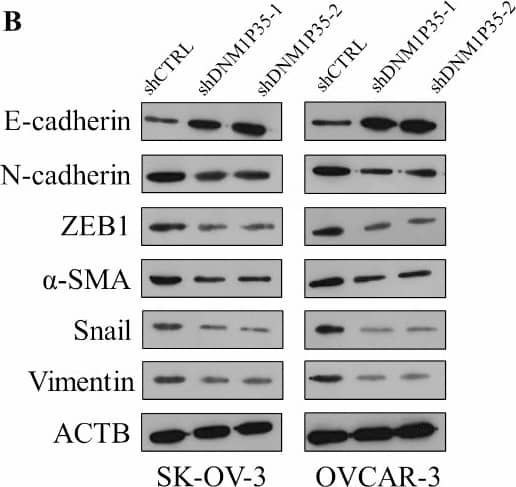 DNM1P35 promotes EMT of ovarian cancer cells. (A,B) The expression of EMT markers were assessed by qPCR (A) and Western blotting (B) in SK-OV-3 and OVCAR-3 cells expressing shCTRL and shDNM1P35. (C,D) The expression of EMT markers were assessed by qPCR (C) and Western blotting (D) in SK-OV-3 and OVCAR-3 cells expressing vector and DNM1P35. (E,F) The expression of EMT markers were assessed by qPCR (E) and Western blotting (F) in SK-OV-3 and OVCAR-3 cells expressing shCTRL and shZEB1. (G,H) The expression of EMT markers were assessed by qPCR (G) and Western blotting (H) in SK-OV-3 and OVCAR-3 cells expressing shCTRL and shZEB1 and overexpression of DNM1P35. ***, p < 0.001, ****, p < 0.0001. ns, not significant. Image collected and cropped by CiteAb from the following open publication (//pubmed.ncbi.nlm.nih.gov/39732940), licensed under a CC-BY license. Not internally tested by Novus Biologicals.