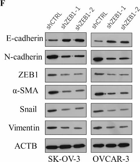 DNM1P35 promotes EMT of ovarian cancer cells. (A,B) The expression of EMT markers were assessed by qPCR (A) and Western blotting (B) in SK-OV-3 and OVCAR-3 cells expressing shCTRL and shDNM1P35. (C,D) The expression of EMT markers were assessed by qPCR (C) and Western blotting (D) in SK-OV-3 and OVCAR-3 cells expressing vector and DNM1P35. (E,F) The expression of EMT markers were assessed by qPCR (E) and Western blotting (F) in SK-OV-3 and OVCAR-3 cells expressing shCTRL and shZEB1. (G,H) The expression of EMT markers were assessed by qPCR (G) and Western blotting (H) in SK-OV-3 and OVCAR-3 cells expressing shCTRL and shZEB1 and overexpression of DNM1P35. ***, p < 0.001, ****, p < 0.0001. ns, not significant. Image collected and cropped by CiteAb from the following open publication (//pubmed.ncbi.nlm.nih.gov/39732940), licensed under a CC-BY license. Not internally tested by Novus Biologicals.