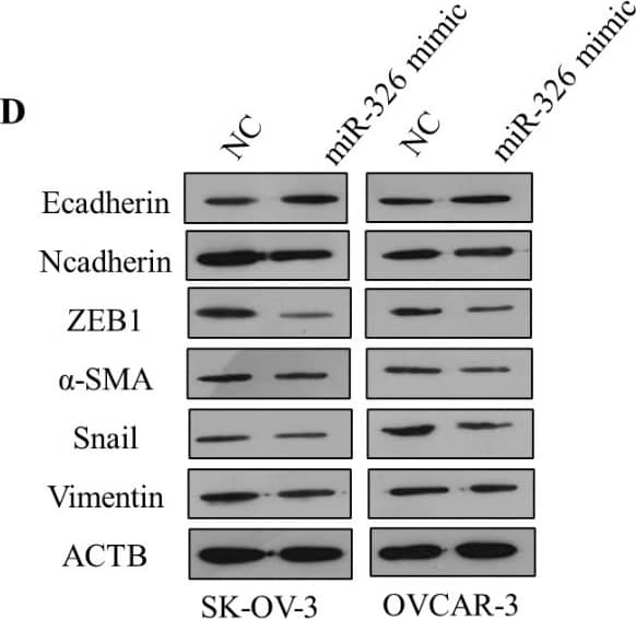 DNM1P35 targets miR-326 to promote ovarian cancer progression and EMT. (A) The potential target of DNM1P35 was predicted by the STAR (database. (B) Dual-luciferase activity assay in HEK293T cells expressing WT and MUT DNM1P35 luciferase reporter and treated with miR-NC or miR-326. (C) The expression of ZEB1 in SK-OV-3 and OVCAR-3 cells transfected with miR-NC and miR-326 was determined by qPCR. (D) The expression of EMT markers in SK-OV-3 and OVCAR-3 cells transfected with miR-NC and miR-326 was determined by Western blotting. (E) The growth of ovarian cancer cells was assessed by CCK-8 assay. (F) SK-OV-3 and OVCAR-3 cell colonies were stained by crystal violet. (G) Migration of SK-OV-3 and OVCAR-3 cells was measured by wound healing assay. (H) Invasion of SK-OV-3 and OVCAR-3 cells was measured by trans-well assay. ***, p < 0.001. Image collected and cropped by CiteAb from the following open publication (//pubmed.ncbi.nlm.nih.gov/39732940), licensed under a CC-BY license. Not internally tested by Novus Biologicals.