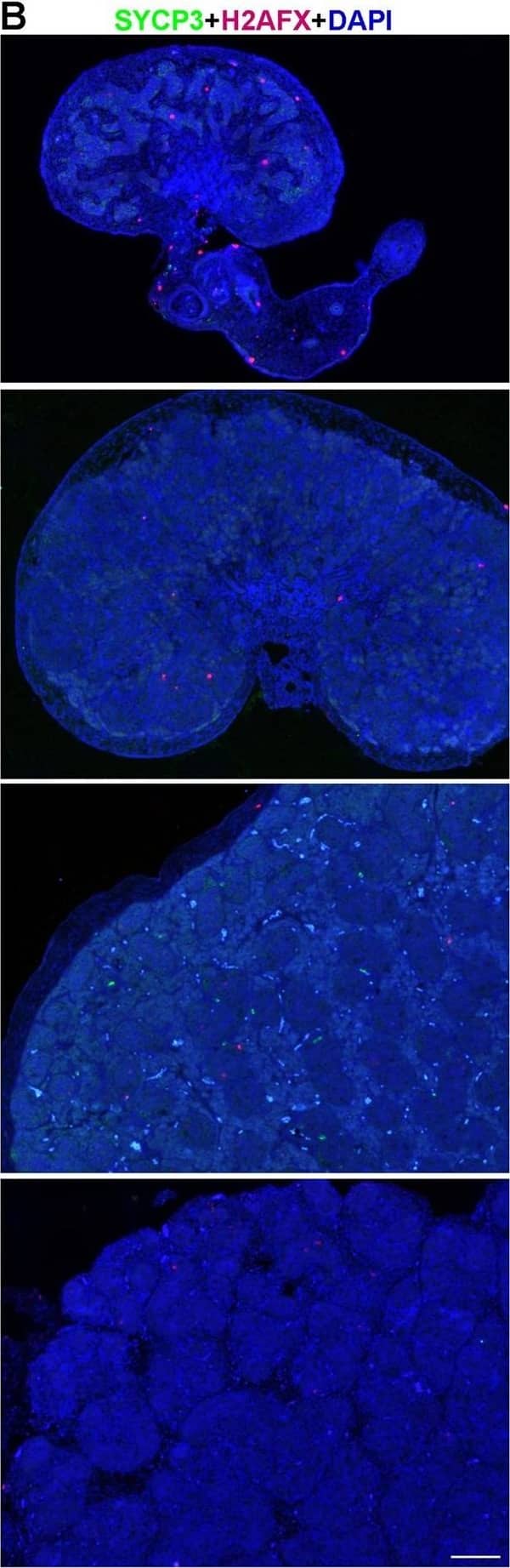 Immunocytochemistry/ Immunofluorescence: SCP3/SYCP3 Antibody - BSA Free [NB300-232] - Dynamic expression of germ cell markers in human fetal testes. (A) Histological sections of human testes at W10, W12, W17 & W22, immunostained for the early germ cell marker (nuclear) POU5F1 (red) & late germ cell marker (cytoplasmic) DDX4 (green). Inserts are magnifications of the dotted boxes. (B) Histological sections of human ovaries at W10, W12, W17 & W22, immunostained for the meiotic markers H2AFX (red) & SYCP3 (green). Note the presence of autofluorescent red blood cells. Scale bars are 200 µm & in the magnified inserts 20 µm. Image collected & cropped by CiteAb from the following publication (//pubmed.ncbi.nlm.nih.gov/26834021), licensed under a CC-BY license. Not internally tested by Novus Biologicals.