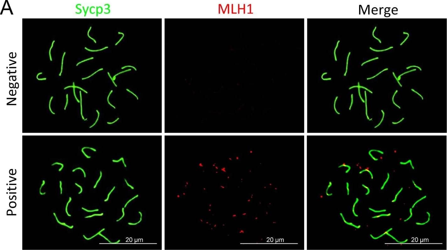 Immunocytochemistry/ Immunofluorescence: SCP3/SYCP3 Antibody - BSA Free [NB300-232] - Effects of MLT on mismatch repair in DEHP-exposed fetal oocytes. (A)The immunofluorescence with Sycp3 (green) & MLH1 (red) in fetal oocytes. (B) The percentages of positive & negative MLH1 signal in oocytes (control: 23.63 ± 0.55%, 76.37 ± 0.55%; DEHP: 77.01 ± 4.41%, 22.99 ± 4.41%; DEHP+MLT: 55.04 ± 17.04%, 43.87 ± 17.08%). (C & D) The amounts of the MLH1 positive foci in pachytene (control: 7.91 ± 1.33; DEHP: 13.97 ± 0.95; DEHP+MLT: 6.74 ± 0.58) & diplotene (control: 12.11 ± 1.74; DEHP: 13.18 ± 1.16; DEHP+MLT: 7.58 ± 1.07) oocytes, respectively. The results were presented as mean ± SEM. *P < 0.05, ** P < 0.01. Image collected & cropped by CiteAb from the following publication (//pubmed.ncbi.nlm.nih.gov/30591620), licensed under a CC-BY license. Not internally tested by Novus Biologicals.