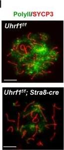 Immunocytochemistry/ Immunofluorescence: SCP3/SYCP3 Antibody - BSA Free [NB300-232] - Hyper-5hmC resulted from UHRF1 deletion.a Venn diagram depicting reduced transcripts associated with 5hmC downregulation. b 5hmC level of meiosis prophase I spermatocytes (16 dpp). c 5hmC densities of all chromosomes. d The distribution of 5hmC density on the genome of spermatocytes. e Venn diagram depicting 5hmC peaks in Uhrf1f/f;Stra8-cre & Uhrf1f/f spermatocytes. f 5hmC densities was shown in the proximal promoter, TSS, & gene body regions of the DEGs. g 5hmC densities in TSSs of the total refgenes with different RPKMs. h The percentage of RNA polymerase II staining in pachynema. i Double immunofluorescence of testicular spread preparations, SYCP3 (red) & RNA polymerase II (green). Scale bar, 5 μm in i. Image collected & cropped by CiteAb from the following publication (//pubmed.ncbi.nlm.nih.gov/32081844), licensed under a CC-BY license. Not internally tested by Novus Biologicals.