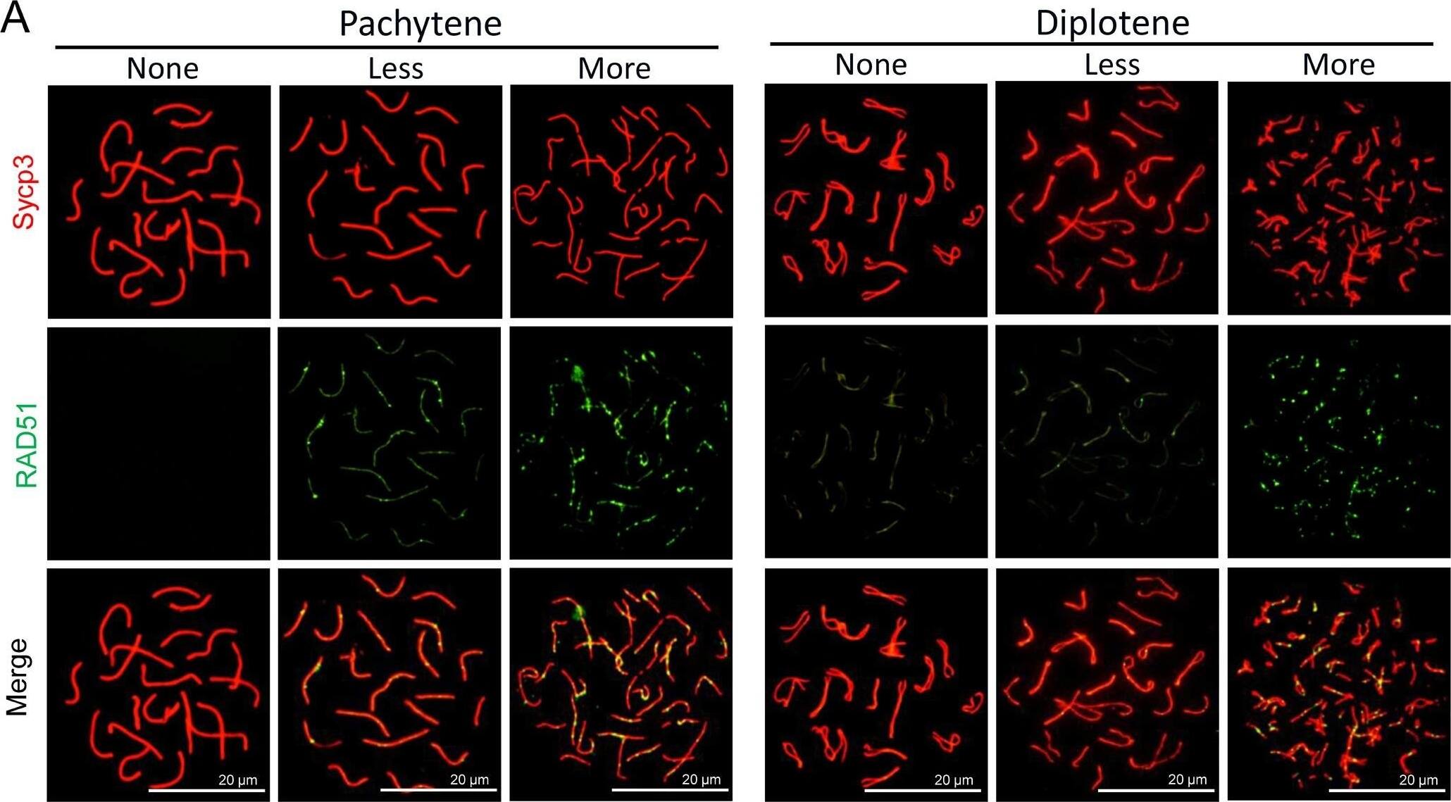 Immunocytochemistry/ Immunofluorescence: SCP3/SYCP3 Antibody - BSA Free [NB300-232] - Effects of MLT on HR in DEHP-exposed fetal oocytes. (A)The immunofluorescence with Sycp3 (red) & RAD51 (green) in fetal oocytes. (B) The percentages of more, less & none staining of RAD51 in all MPI stages (control: 32.48 ± 2.54%, 67.52 ± 2.54%; DEHP: 59.83 ± 7.44%, 40.17 ± 7.44%; DEHP+MLT: 33.13 ± 2.79%, 66.87 ± 2.79%). (C) The percentages of more, less & none staining of RAD51 in pachytene & diplotene oocytes (control: 36.27 ± 8.02%, 19.09 ± 1.03%, 44.64 ± 8.08%; DEHP: 44.24 ± 2.98%, 22.50 ± 4.28%, 33.26 ± 1.30%; DEHP+MLT: 32.97 ± 4.27%, 22.00 ± 1.03%, 45.03 ± 4.76%). The results were presented as mean ± SEM. *P < 0.05, ** P < 0.01. Image collected & cropped by CiteAb from the following publication (//pubmed.ncbi.nlm.nih.gov/30591620), licensed under a CC-BY license. Not internally tested by Novus Biologicals.
