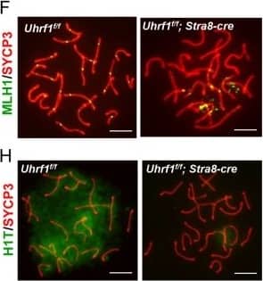 Immunocytochemistry/ Immunofluorescence: SCP3/SYCP3 Antibody - BSA Free [NB300-232] - UHRF1 deficiency resulted in impaired meiotic recombination & defective pachynema.a Double immunofluorescence of SYCP3 (green) & DMC1 (red) in testicular spread preparations. b, c The number of DMC1 foci in zygotene stage (b) & pachytene stage (c). d Immunostaining for SYCP3 (red) &  gamma H2AX (green). e The percentage of abnormal  gamma H2AX foci in the pachytene stage. f Immunostaining for SYCP3 (red) & MLH1 (green). g The number of MLH1 foci in pachynema. h Immunostaining for SYCP3 (red) & H1t (green). i The percentage of spermatocytes with H1T staining. ***p ≤ 0.001; *p ≤ 0.05. Scale bar, 5 μm in a, d, f, h. Image collected & cropped by CiteAb from the following publication (//pubmed.ncbi.nlm.nih.gov/32081844), licensed under a CC-BY license. Not internally tested by Novus Biologicals.