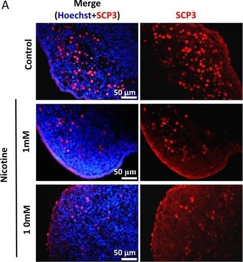 Immunocytochemistry/ Immunofluorescence: SCP3/SYCP3 Antibody - BSA Free [NB300-232] - Dose-dependent decrease or increase of the number of meiotic germ cells (SCP3, MLH1) & of  gamma H2AX positive cell, respectively, in nicotine treated fetal ovaries cultured for 4 days. (A) Representative IF images of ovarian tissue sections for SCP3; (B) representative IF images of ovarian tissue sections for MLH1 &  gamma H2AX; (C) Relative percentage of SCP3 & MLH1 positive cells of ovaries cultured without (control) & with 1mM or 10mM nicotine. All experiments were repeated at least three times. (*) & (**) indicate significant (P < 0.05) & highly significant (P < 0.01) difference, respectively. Image collected & cropped by CiteAb from the following publication (//pubmed.ncbi.nlm.nih.gov/30001218), licensed under a CC-BY license. Not internally tested by Novus Biologicals.