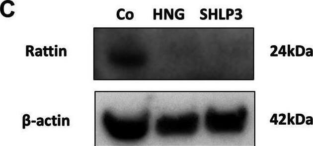 HNG decreases Rattin expression in gentamicin-exposed cochlear hair cells.The expression of Rattin in OC explants was measured by real-time PCR. OC explants were treated with 200 μM gentamicin (GM) in combination with or without 1 uM HNG (A) or 0.1 uM SHLP3 (B) for 6 h and 16 h. At least three explants were used as sample pool for each condition. Values are presented as mean+S.D. *P < 0.05, ns no significant between all groups. C Western blot results showing the expression of RATTIN after 24-h peptide treatment (1 uM HNG or 0.08 uM SHLP3). At least six explants were used as a sample pool for each condition. Image collected and cropped by CiteAb from the following open publication (//pubmed.ncbi.nlm.nih.gov/39433756), licensed under a CC-BY license. Not internally tested by Novus Biologicals.