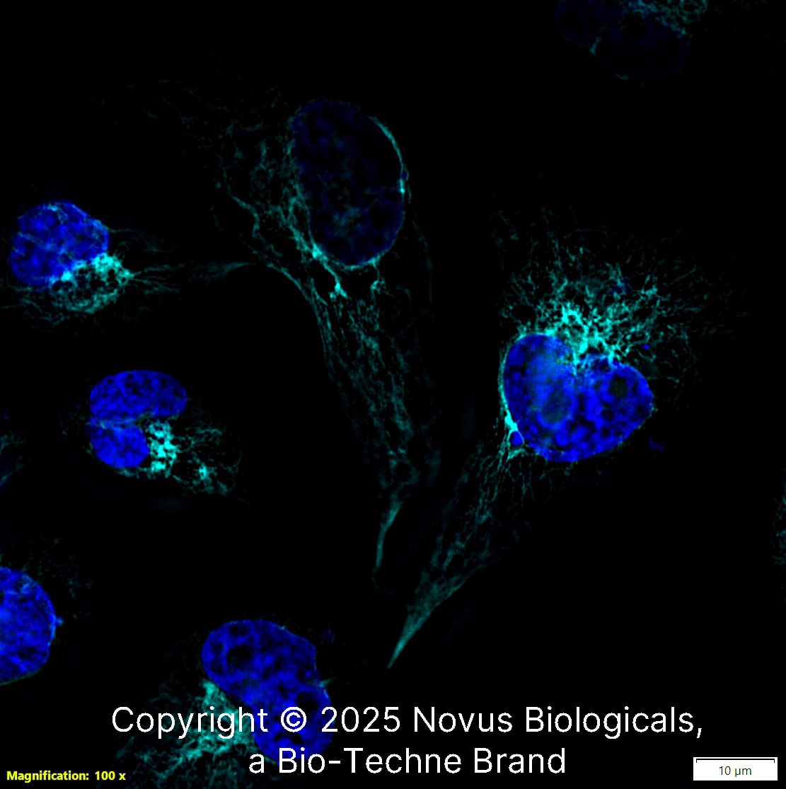 Nestin (10C2) was detected in immersion fixed SJCRH30 human Rhabdomyosarcoma cell line with Mouse anti-Nestin (10C2) Protein-G purified Monoclonal Antibody conjugated to DyLight 650 (Catalog # NB300-266C) (light blue) at 5 µg/mL overnight at 4C. Cells were counterstained with DAPI (dark blue). Cells were imaged using a 100X objective and digitally deconvolved.