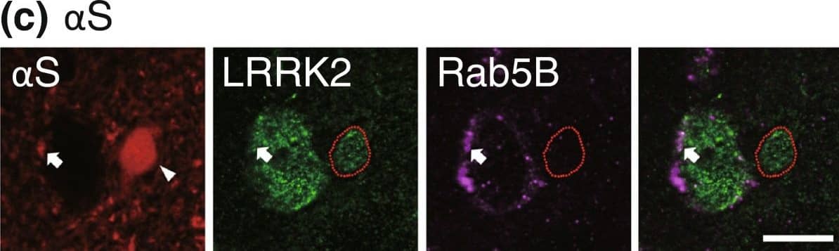 Immunocytochemistry/ Immunofluorescence: LRRK2 Antibody - BSA Free [NB300-268] - LRRK2 accumulates in globules in  alpha S tg mice. (a & b) Double immunofluorescence for  alpha S with parkin, PINK1, DJ-1, LRRK2, or negative control (the immunopeptide-preabsorbed anti-LRRK2 antibody) in  alpha S tg mice (a) & P123H  beta S tg mice (b). Note that  alpha S-globules were immunopositive for LRRK2 (~79%, n = 22), whereas P123H  beta S globules were negative for LRRK2. Representative images are shown for the thalamus ( alpha S) & basal ganglia (P123H  beta S). Scale bar = 5 μm for all panels. (c) Triple immunofluorescence for  alpha S, LRRK2 & Rab5B for basal ganglia in  alpha S tg mice. LRRK2 & Rab5B were colocalized in axon terminal (arrow), but were not colocalized in the  alpha S-globule (arrowhead) Scale bar = 10 μm for all panels. Image collected & cropped by CiteAb from the following publication (//molecularbrain.biomedcentral.com/articles/10.1186/1756-6606-5-34), licensed under a CC-BY license. Not internally tested by Novus Biologicals.