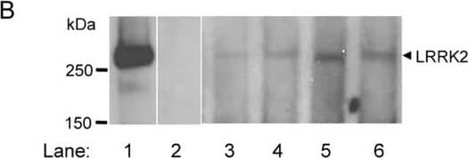 Western Blot: LRRK2 Antibody - BSA Free [NB300-268] - Western blotting of LRRK2. A. Recombinant LRRK2 (arrowhead) from transfected (+) HEK 293T & M17 cells was specifically recognized by all four LRRK2 antibodies (Ab1, Ab2, Ab3, & Ab4) used in this study. LRRK2 was not recognized in non-transfected cells (-). B. Recombinant LRRK2 (arrowhead) from transfected M17 cells is detected by anti-LRRK2 Ab4 (lane 1), but not after absorption of the antibody with its peptide antigen (lane 2). Brain LRRK2 was recognized by anti-LRRK2 Ab4 in two controls (lanes 3 & 4) & two PD cases (lanes 5 & 6). Cell lysates (10 μg protein) & brain homogenates (100 μg protein) were prepared & loaded on 6% SDS-PAGE gels for Western blot analysis using anti-LRRK2 antibodies Ab1–Ab4 in (A) & Ab4 in (B). Image collected & cropped by CiteAb from the following publication (//pubmed.ncbi.nlm.nih.gov/17137507), licensed under a CC-BY license. Not internally tested by Novus Biologicals.