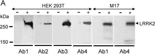 Western Blot: LRRK2 Antibody - BSA Free [NB300-268] - Western blotting of LRRK2. A. Recombinant LRRK2 (arrowhead) from transfected (+) HEK 293T & M17 cells was specifically recognized by all four LRRK2 antibodies (Ab1, Ab2, Ab3, & Ab4) used in this study. LRRK2 was not recognized in non-transfected cells (-). B. Recombinant LRRK2 (arrowhead) from transfected M17 cells is detected by anti-LRRK2 Ab4 (lane 1), but not after absorption of the antibody with its peptide antigen (lane 2). Brain LRRK2 was recognized by anti-LRRK2 Ab4 in two controls (lanes 3 & 4) & two PD cases (lanes 5 & 6). Cell lysates (10 μg protein) & brain homogenates (100 μg protein) were prepared & loaded on 6% SDS-PAGE gels for Western blot analysis using anti-LRRK2 antibodies Ab1–Ab4 in (A) & Ab4 in (B). Image collected & cropped by CiteAb from the following publication (//pubmed.ncbi.nlm.nih.gov/17137507), licensed under a CC-BY license. Not internally tested by Novus Biologicals.