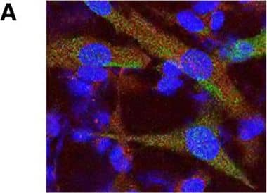 Immunocytochemistry/ Immunofluorescence: LRRK2 Antibody - BSA Free [NB300-268] - The interaction & phosphorylation of LRRK2 & LC1. (A) Cellular co-localisation of endogenous LRRK2 & MAP1B (LC1). SKNSH cells were labelled with LRRK2 (green) & LC1 (red) antibodies & signals were detected by immunofluorescence. Detailed figure in Additional file 1. (B) LRRK2 kinase assay. The LRRK2 wild-typed (WT) kinase interacted & phosphorylated the LC1 domain unlike the LRRK2 kinase-dead protein. (C) Western blotting of LRRK2 & LC1 proteins after a kinase assay. Both LRRK2 & LC1 proteins were probed for phospho-threonine & phospho-serine signals respectively. Image collected & cropped by CiteAb from the following publication (//molecularbrain.biomedcentral.com/articles/10.1186/1756-6606-7-29), licensed under a CC-BY license. Not internally tested by Novus Biologicals.