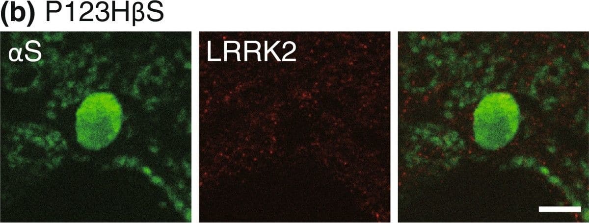 Immunocytochemistry/ Immunofluorescence: LRRK2 Antibody - BSA Free [NB300-268] - LRRK2 accumulates in globules in  alpha S tg mice. (a & b) Double immunofluorescence for  alpha S with parkin, PINK1, DJ-1, LRRK2, or negative control (the immunopeptide-preabsorbed anti-LRRK2 antibody) in  alpha S tg mice (a) & P123H  beta S tg mice (b). Note that  alpha S-globules were immunopositive for LRRK2 (~79%, n = 22), whereas P123H  beta S globules were negative for LRRK2. Representative images are shown for the thalamus ( alpha S) & basal ganglia (P123H  beta S). Scale bar = 5 μm for all panels. (c) Triple immunofluorescence for  alpha S, LRRK2 & Rab5B for basal ganglia in  alpha S tg mice. LRRK2 & Rab5B were colocalized in axon terminal (arrow), but were not colocalized in the  alpha S-globule (arrowhead) Scale bar = 10 μm for all panels. Image collected & cropped by CiteAb from the following publication (//molecularbrain.biomedcentral.com/articles/10.1186/1756-6606-5-34), licensed under a CC-BY license. Not internally tested by Novus Biologicals.