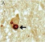 Immunohistochemistry-Paraffin: LRRK2 Antibody - BSA Free [NB300-268] - Specificity of immunostaining for LRRK2. Specificity of the antibodies used for immunocytochemistry was determined by performing adsorptions with the corresponding peptide sequences. Immunochemical localization of LBs (arrows) by Ab4 against LRRK22500–2527 (A) & Ab1 against LRRK2900–100 (C) was blocked using respective peptide antigens (B & D). Adjacent sections with LB within pigmented neurons from the substantia nigra of a case of PD were used. Scale bar: 20 μm. Image collected & cropped by CiteAb from the following publication (//pubmed.ncbi.nlm.nih.gov/17137507), licensed under a CC-BY license. Not internally tested by Novus Biologicals.