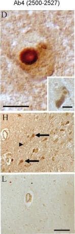 Immunohistochemistry-Paraffin: LRRK2 Antibody - BSA Free [NB300-268] - Immunocytochemistry of LRRK2 in PD. Four antibodies raised against sequences corresponding to various regions shown on the schematic diagram of LRRK2 (red bars) were used on brainstem sections of PD (A-H) & age-matched controls (I-L). Intense immunolabeling of brainstem LBs in cases of PD was seen with Ab1 against LRRK2900–100 (A) & Ab4 against LRRK22500–2527(D). Both rim (A & D) & core (inset in D) of LBs were recognized. In contrast, LBs were not labelled in any case using antibodies directed against LRRK21246–1265 (Ab2, B) or LRRK21838–2133 (Ab3, C), for which the antigenic sites are located within the folded domains. The cell bodies of both pigmented & no-pigmented neurons (arrows) as well as axons (arrowheads) contain LRRK2, seen only using antibodies against sites outside the folded domains (Ab1, E & Ab4, H). In contrast, Ab4 staining was much less intense in control tissue (L). The muscle layer of both large & small vessels was consistently found to contain high levels of LRRK2 in almost all PD cases (seen in E, G, & H) & strikingly the vessels are the only structure immunolabeled with Ab3 recognizing LRRK21838–2133 in all cases studied (G & K). Ab2 to LRRK21246–1265 did not recognize LBs, cell bodies or vessels in any case (B, F, & J). Scale bars: A-D & inset = 10 μm; E-L = 100 μm. Image collected & cropped by CiteAb from the following publication (//pubmed.ncbi.nlm.nih.gov/17137507), licensed under a CC-BY license. Not internally tested by Novus Biologicals.