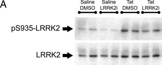 Western Blot: LRRK2 Antibody - BSA Free [NB300-268] - LRRK2 kinase inhibition blocks Tat-induced S935 phosphorylation & inflammatory cytokine expression in BV-2 cells. (A) Western blot depicting pS935-LRRK2 & total LRRK2 protein levels 12 hours after saline or Tat-treatment ± LRRK2 kinase inhibition (LRRK2i). (B) Tat treatment significantly increased pS935-LRRK2, which was attenuated by LRRK2i. (C) We measured TNF-alpha , IL-6, MCP-1 & IL-10 mRNA levels by qRT-PCR 12 hours post saline or Tat treatment ± LRRK2i. LRRK2i attenuated Tat-induced TNF-alpha , IL-6, MCP-1 & IL-10 expression for all groups (*P <0.05, ***P <0.001, one way ANOVA, Newman-Keuls post-test). ANOVA, analysis of variance; LRRK2, leucine-rich repeat kinase2; pS935, phosphorylation of serine 935; Tat, trans activator of transcription. Image collected & cropped by CiteAb from the following publication (//jneuroinflammation.biomedcentral.com/articles/10.1186/1742-2094-9-261), licensed under a CC-BY license. Not internally tested by Novus Biologicals.