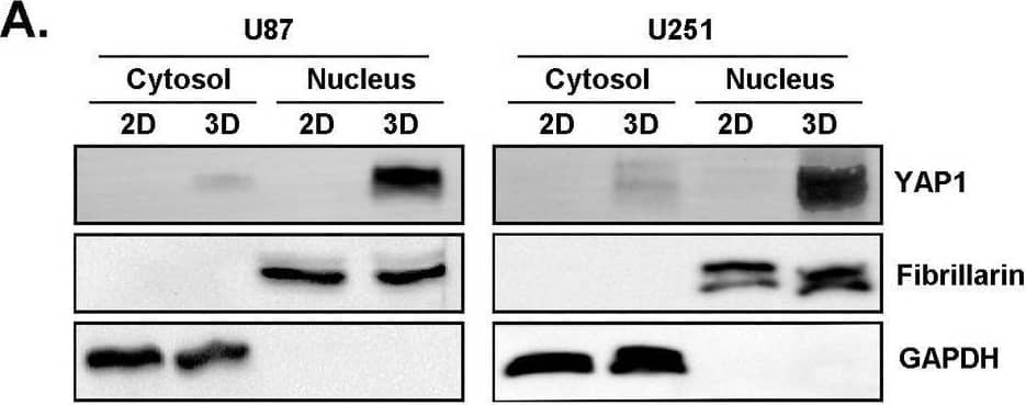 In vitro VM triggers nuclear YAP1 expression in U87 and U251 glioblastoma cells and is inhibited by Hippo pathway pharmacological targeting. (A) Human U87 and U251 glioblastoma cells were seeded either as monolayers (2D) or on top of Cultrex (3D) to generate capillary‐like structures. Subcellular fractionation was performed to isolate the cytosol and nuclear fractions from 2D or 3D cells. Representative blots for YAP1, Fibrillarin and GAPDH are presented from three independent fractionations. (B) Cytosolic (Cyt) and nuclear (Nuc) fractions were isolated from U87 glioblastoma cells seeded on Cultrex and treated with either vehicle or 10 μM of the indicated Hippo pathway inhibitors for 24 h. Representative blots for YAP1 and Fibrillarin are presented from two independent fractionations. (C) Total RNA was extracted from U87 cells cultured as in (A). RT‐qPCR was performed and relative gene expression of CTGF, Cyr61 and PPIA normalised over GAPDH. Data presented are representative triplicates from two independent experiments (*p < 0.05). Image collected and cropped by CiteAb from the following open publication (//pubmed.ncbi.nlm.nih.gov/39718433), licensed under a CC-BY license. Not internally tested by Novus Biologicals.