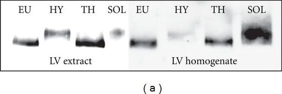 Western blot immunodetection of cardiac MyHC isoforms from left ventricle (LV) homogenates and extracts of adult euthyroid (EU), hypothyroid (HY), and hyperthyroid (TH) Lewis rats. The membranes were stained by NB300-284 antibody recognizing both MyHC alpha  and MyHC beta  isoforms (a) or by BA.G5 antibody, which was solely specific for cardiac MyHC alpha  isoform (b).