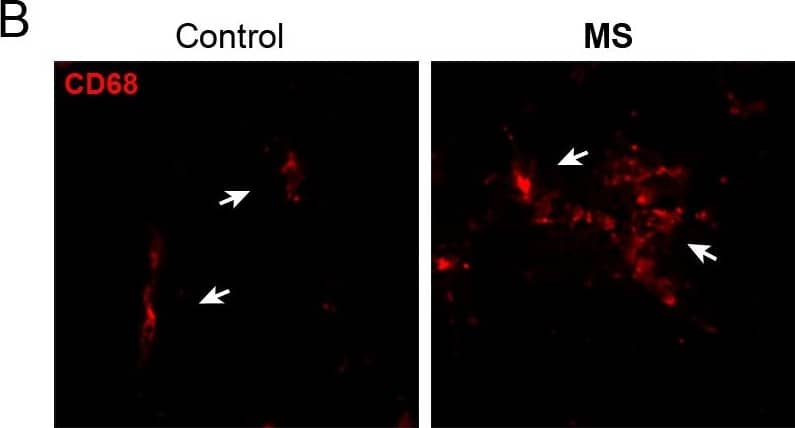 Immunocytochemistry/ Immunofluorescence: xCT Antibody - BSA Free [NB300-317] - xCT expression is enhanced in CD68+ cells from MS spinal cord. A. Triple immunofluorescence staining for xCT (green), CD68 (red) & Hoechst 33258 (blue) in spinal cord of control (left) & MS patients (right). A high expression of xCT was detected in CD68+ infiltrating macrophages (arrows) associated with blood vessels, which are virtually absent in controls. Note that overall xCT expression is enhanced in MS tissue. B. CD68+ cells (arrows) show enhanced xCT expression in MS patients as compared to controls. CD68+ macrophages are round shaped & form clusters in MS patients, whereas in controls, CD68+ cells appear isolated & long shaped. Scale bar = 50 μm. Image collected & cropped by CiteAb from the following publication (//jneuroinflammation.biomedcentral.com/articles/10.1186/1742-2094-8-63), licensed under a CC-BY license. Not internally tested by Novus Biologicals.