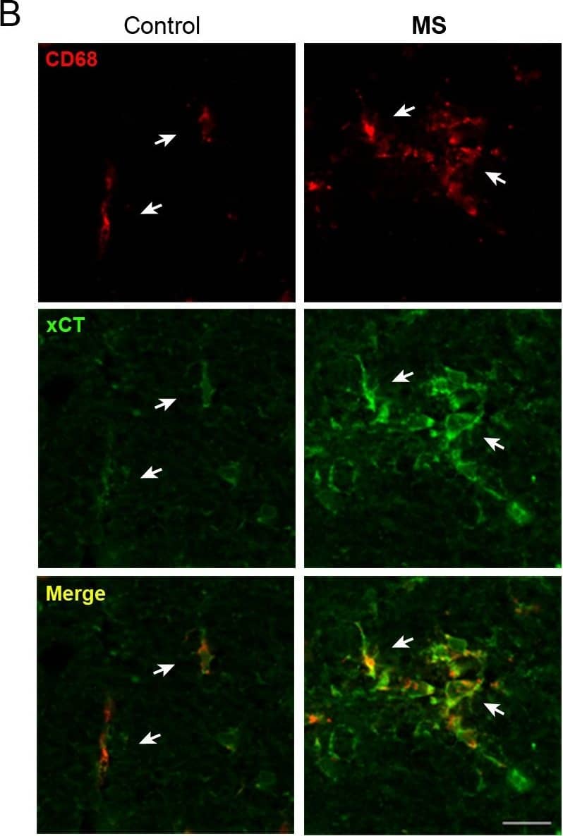 Immunocytochemistry/ Immunofluorescence: xCT Antibody - BSA Free [NB300-317] - xCT expression is enhanced in CD68+ cells from MS spinal cord. A. Triple immunofluorescence staining for xCT (green), CD68 (red) & Hoechst 33258 (blue) in spinal cord of control (left) & MS patients (right). A high expression of xCT was detected in CD68+ infiltrating macrophages (arrows) associated with blood vessels, which are virtually absent in controls. Note that overall xCT expression is enhanced in MS tissue. B. CD68+ cells (arrows) show enhanced xCT expression in MS patients as compared to controls. CD68+ macrophages are round shaped & form clusters in MS patients, whereas in controls, CD68+ cells appear isolated & long shaped. Scale bar = 50 μm. Image collected & cropped by CiteAb from the following publication (//jneuroinflammation.biomedcentral.com/articles/10.1186/1742-2094-8-63), licensed under a CC-BY license. Not internally tested by Novus Biologicals.