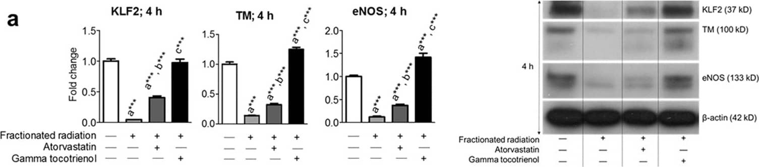 Western Blot: eNOS Antibody - BSA Free [NB300-500] - Mevalonate pathway inhibitors reversed fractionated-radiation–induced suppression of KLF2 & its downstream target molecules. Representative Western blot analysis & quantification of KLF2, TM, & eNOS 4 h after exposure to five fractions of 2 Gy (a) in presence or absence of atorvastatin (1 μM) or GT3 (5 μM) & (b) in presence or absence of GGTi (10 μM) (n = 3).  beta -actin served as a loading control. (n, number of independent experiments performed; a, significant statistical difference between nonirradiated & irradiated groups; b, significant statistical difference between fractionated irradiation & single exposure; *, p < 0.05; **, p < 0.01; ***, p < 0.001). Image collected & cropped by CiteAb from the following publication (//pubmed.ncbi.nlm.nih.gov/32382091), licensed under a CC-BY license. Not internally tested by Novus Biologicals.