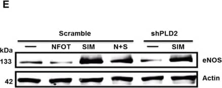 Western Blot: eNOS Antibody - BSA Free [NB300-500] - Upregulation of HMG-CoA reductase in shPLD2 cells decreases eNOS expression. (A) Representative western blot of HMG-CoA reductase in Scramble & shPLD2 cells. The regions of the Western blots containing the HMG-CoA reductase & actin immunoreactive bands were scanned & the relative abundance of the individual samples quantified using an Odyssey CLx imaging system (B) Quantification of western blots with HMG-CoA reductase normalized to actin (n = 4 experiments). (C) N-SIM microscopy of HMG-CoA reductase; Bar, 7.5 μM. (D) RT-PCR of HMG-CoA reductase in Scramble & shPLD2 cells (n = 3). (E) Western blot of eNOS after treatment with NFOT & Simvastatin. Representative image of 3 experiments. The regions of the Western blots (Suppl. Figure 2) containing the eNOS & actin immunoreactive bands were scanned & the relative abundance of the individual samples quantified using an Odyssey CLx imaging system. (F) Quantification of western blots with eNOS levels normalized to actin (n = 3). Comparisons without bars made to untreated Scramble values. (G) eNOS activity after treatment with Simvastatin (n = 7). Mean ± SEM; *p < 0.05; **p < 0.01; ***p ≤ 0.001; One-way ANOVA with Bonferroni’s Multiple Comparison Test. Image collected & cropped by CiteAb from the following publication (//pubmed.ncbi.nlm.nih.gov/28831159), licensed under a CC-BY license. Not internally tested by Novus Biologicals.