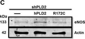 Western Blot: eNOS Antibody - BSA Free [NB300-500] - The human PLD2 polymorphism R172C does not alter eNOS signaling but does decrease caveolin-1 protein levels. Overexpression of HA-tagged hPLD2 (A) & HA-R172C-PLD2 (B) in HeLa cells, visualized using anti-HA immunofluorescent staining (green). Arrowhead, PLD2 localization in filopodia; chevron, in peripheral actin ruffles; *, in dorsal actin ruffles; arrow, in subcortical actin network. Bar, 7.5 μM. Representative image of multiple experiments. (C) Representative western blot of eNOS after transfection of HA-hPLD2 or HA-R172C-PLD2 into shPLD2 cells. The regions of the Western blots containing the eNOS & actin immunoreactive bands were scanned & the relative abundance of the individual samples quantified using an Odyssey CLx imaging system. (D) Quantification of western blotting with eNOS levels normalized to actin (n = 3). (E) eNOS activity as measured by nitrate formation (n = 7). Lane 1 vs 2, P = 0.0021; lane 2 vs 3, P = 0.00035; lane 2 vs 4, P = 0.00012. (F–I) N-SIM microscopy of plasma membrane eNOS & caveolin-1. Bar, 7.5 μM. Representative image of multiple Scramble or shPLD2 cells imaged. Cells in H & I were selected for imaging based on expression of HA-hPLD2 or HA-R172C-PLD2 as visualized by anti-HA immunofluorescence in a separate channel (not shown). Mean ± SEM; *p < 0.05; **p < 0.01; ***p ≤ 0.001; One-way ANOVA with Bonferroni’s Multiple Comparison Test. Image collected & cropped by CiteAb from the following publication (//pubmed.ncbi.nlm.nih.gov/28831159), licensed under a CC-BY license. Not internally tested by Novus Biologicals.