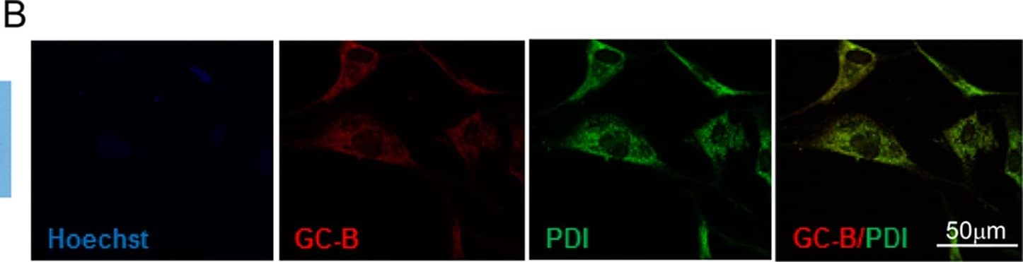 Immunocytochemistry/ Immunofluorescence: Protein Disulfide Isomerase/P4HB Antibody (RL90) [NB300-517] - Cell surface PDI associated with GC-A & GC-B.A. & C. Proteins were pulled down with anti GC-A or anti GC-B antibodies from HUVEC or HMC membrane preparations & detected with anti-PDI antibody (RL90)compared to control IP (no anti GC-A or anti GC-B antibody) & non-immunoprecipitated proteins from HMC & HUVEC. B. Co-localization of PDI (red) & GC-A (green) in HUVEC. D. Co-localization of PDI (green) & GC-B (red) in HMC. Image collected & cropped by CiteAb from the following publication (//dx.plos.org/10.1371/journal.pone.0112986), licensed under a CC-BY license. Not internally tested by Novus Biologicals.