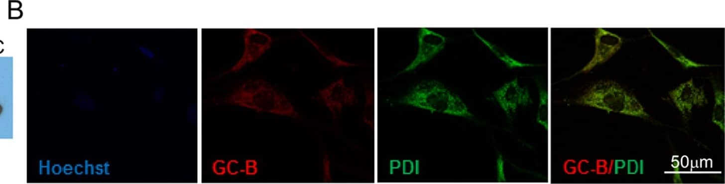 Immunocytochemistry/ Immunofluorescence: Protein Disulfide Isomerase/P4HB Antibody (RL90) [NB300-517] - Cell surface PDI associated with GC-A & GC-B.A. & C. Proteins were pulled down with anti GC-A or anti GC-B antibodies from HUVEC or HMC membrane preparations & detected with anti-PDI antibody (RL90)compared to control IP (no anti GC-A or anti GC-B antibody) & non-immunoprecipitated proteins from HMC & HUVEC. B. Co-localization of PDI (red) & GC-A (green) in HUVEC. D. Co-localization of PDI (green) & GC-B (red) in HMC. Image collected & cropped by CiteAb from the following publication (//dx.plos.org/10.1371/journal.pone.0112986), licensed under a CC-BY license. Not internally tested by Novus Biologicals.