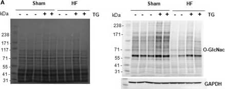 Western Blot: O-GlcNAc Antibody (RL2) - BSA Free [NB300-524] - Analysis of O-GlcNAcylated LV proteins by Western blot & WGA-SDS-PAGE gel electrophoresis. (A) Red ponceau staining (left panel) & western blot (right panel) of O-GlcNAcylated proteins (50 μg) extracted from sham- & HF-rats treated or not with thiamet G. The positions of molecular weight are indicated as kilodalton (kDa) on the left. (B) Red ponceau staining (left panel) & WGA-SDS-PAGE of O-GlcNAcylated proteins levels (middle panel) of O-GlcNAcylated desmin levels (right panel) from the same samples. The arrow in desmin WGA gels indicates the non-O-GlcNAcylated form. Image collected & cropped by CiteAb from the following publication (//pubmed.ncbi.nlm.nih.gov/30344511), licensed under a CC-BY license. Not internally tested by Novus Biologicals.