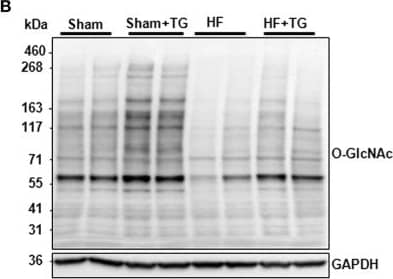 Western Blot: O-GlcNAc Antibody (RL2) - BSA Free [NB300-524] - Effect of OGA inhibition by thiamet G in isolated perfused heart. (A) Description of the protocol designed for thiamet G (TG) perfusion in sham- (n = 6) & HF- (n = 7) rats 6 weeks post-MI. (B) Western blot (left panel) & quantification (right panel) of O-GlcNAcylated proteins levels measured in proteins extracted from LVs of isolated perfused sham- & HF-rat hearts treated or not with 100 μM thiamet G for 2 h (n = 7 in each group). (C) Western blots (upper panel) & quantification (lower panel) of total desmin levels in the same samples. (D) Phosphorylation profiles of desmin were analyzed in the same samples by Phos-tag™ gel. Graphs show mean ± SEM values expressed in arbitrary units (A.U.). The positions of molecular weight are indicated as kilodalton (kDa) on the left. *P < 0.05; ** < 0.01. Image collected & cropped by CiteAb from the following publication (//pubmed.ncbi.nlm.nih.gov/30344511), licensed under a CC-BY license. Not internally tested by Novus Biologicals.